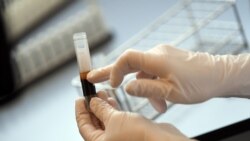 onja Krauthoefer of the University Hospital Erlangen checks donated blood and plasma samples to determine whether the blood of the donor can be used to produce therapeutic plasma to treat of seriously ill patients, in Erlangen, Germany, on April 7, 2020. (Andreas Gebert / Reuters)