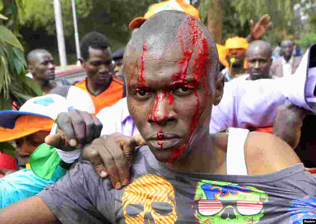 Mfuasi wa Mungano wa upinzani wa CORD ameumia kichwa wakati wa ghasia zilipozuka pale polisi walipopambana na wafuasi wa upinzani kabla ya mkutano wa&nbsp; &quot;Saba Saba&quot; kwenye uwanja wa Uhuru park mjini Nairobi, July 7, 2014.