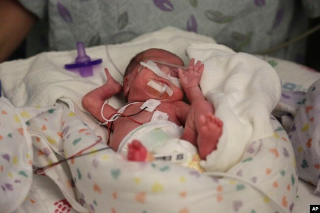 FILE - Hospital staff prepare "preemie" twin Olivia Niedermeyer to undergo an eye exam at Advocate Children's Hospital in Chicago, March 15, 2016.