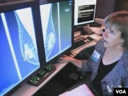 Mammograms are often considered the most powerful weapon in the war against breast cancer.