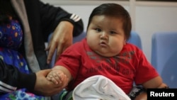FILE - Eight-month-old Santiago Mendoza sits at a clinic for the obese in Bogota, March 19, 2014. (REUTERS/John Vizcaino)