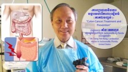 Hello VOA សុខភាព៖ ការទៅ​​​ឆ្លុះ​ពោះវៀន​ឲ្យ​បាន​ឆាប់​និង​ការ​វះកាត់​ជា​វិធី​បង្ការ​និង​ព្យាបាល​សំ​ខាន់​បំផុត​ចំពោះ​​មហារីក​ពោះវៀន