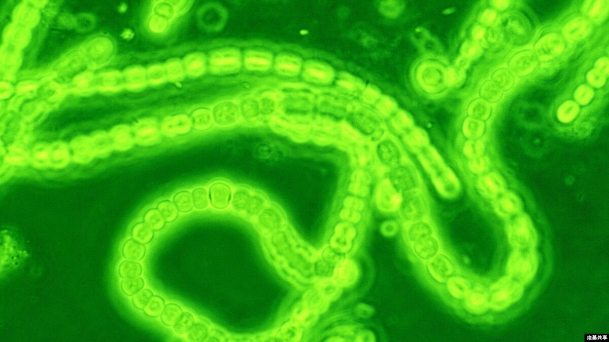 OxygenProducing Bacteria Could Help Heart Attack Sufferers