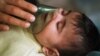 Studi: Bayi yang Kurang Terpapar Bakteri Tertentu Berisiko Asma