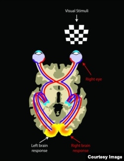 Stimulating the left or right eye in normal sighted individuals results in a symmetrical brain response shown as yellow areas in the visual cortex located in the back of the brain. This is because each eye is connected to both sides of the brain roughly equally and the connectivity of the visual pathways is alike. (Credit: Illustrated by Elena Nikonova)