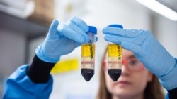 Istraživači na Univerzitetu Oksford razvijaju vakcinu u saradnji sa kompanijom "Astra Zeneka"