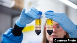 In this undated photo from the University of Oxford, a researcher works on the coronavirus vaccine developed by AstraZeneca and Oxford University. (University of Oxford/John Cairns)