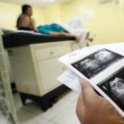 Gambar ultrasound saat pemeriksaan kehamilan di sebuah rumah sakit bersalin (Foto: ilustrasi).