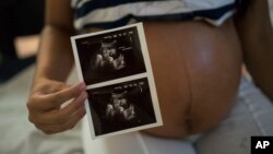 FILE - Isabela Cristina, 18, who is six months pregnant, shows a photo of her ultrasound at the IMIP hospital in Recife, Pernambuco state, Brazil.
