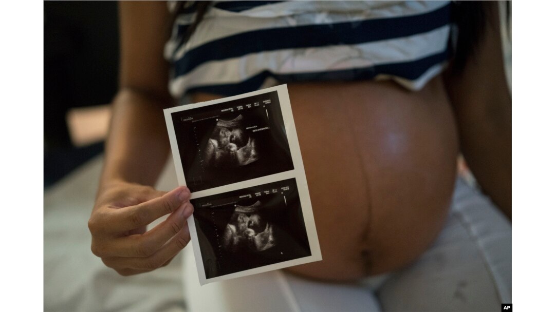 Isabela Cristina, 18, who is six months pregnant, shows a photo of her ultrasound at the IMIP hospital in Recife, Pernambuco state, Brazil, Feb. 3, 2016.