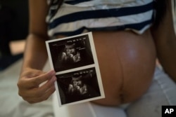 Isabela Cristina, 18, who is six months pregnant, shows a photo of her ultrasound at the IMIP hospital in Recife, Pernambuco state, Brazil, Feb. 3, 2016.