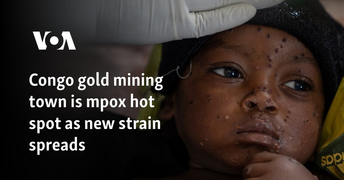 Congo gold-mining town is mpox hot spot as new strain spreads