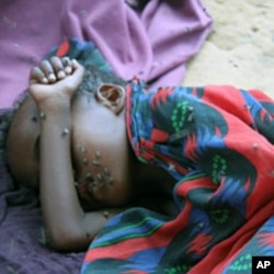 A very sick child lies covered with flies at a Mogadishu IDP camp