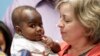 Bayi Pantai Gading Dipisahkan dari Tubuh Kembar Parasit