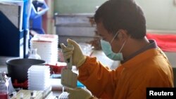 A staff member works on a blood sample of a chicken at the Veterinary Research Bureau.