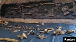 FILE - Human skeleton bones discovered in a previously unknown Anglo-Saxon cemetery in Norfolk are seen at the offices of MOLA (Museum of London Archaeology) in Northampton, central England, Nov. 16, 2016.