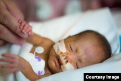 Micro preemie cared for at Children's National NICU in Washington, D.C.