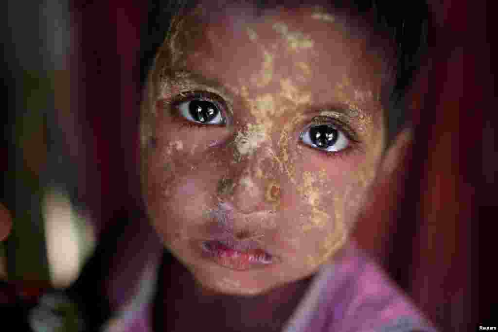 تصویر یک دختر بچه آواره روهینگیایی با صورت آرایش کرده در کمپ پناهندگان بنگلادش &nbsp;