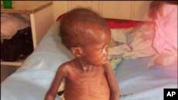 South African child shows effects of HIV infection