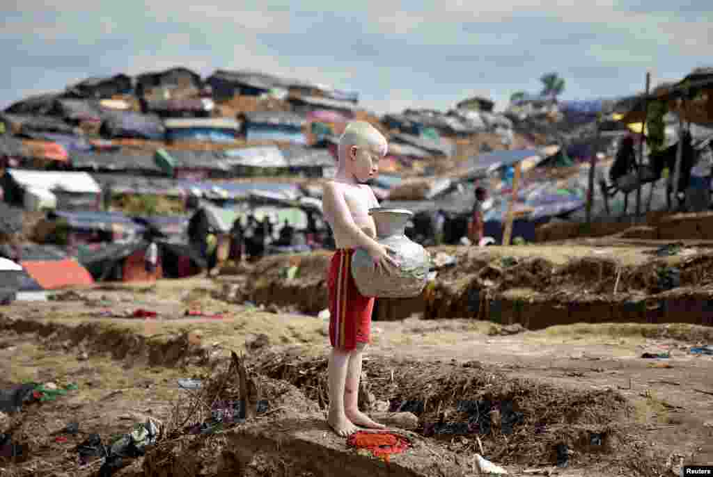 색소부족 유전병 &#39;알비노(백색증)&#39; 환자인 로힝야족 어린이가 방글라데시 콕스바자르 난민촌에서 땅을 바라보고 있다.