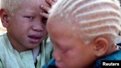 FILE - Albino twins beg for money at the entrance to the main mosque in Senegal's second city of Touba, March 29, 2005. 