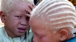 Órgãos de indivíduos com albinismo não têm poderes mágicos, recorda o chefe da ONU - 3:01