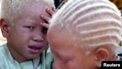 FILE - Albino twins are seen in Africa, March 29, 2005. 