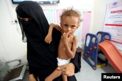 FILE - The mother of malnourished Ferial Elias, 2, holds her at a malnutrition treatment ward at al-Thawra hospital in Hodeida, Yemen, Nov. 3, 2018.