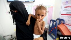Ferial Elias, 2 ans, souffrant de malnutrition et sa mère, à l'hôpital al-Thawra de Hodeida, au Yémen, le 3 novembre 2018.