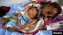Jednogodišnja devojčica u bolnici u Jemenu, 3. novembar 2018.