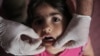 Iraq mở chiến dịch chủng ngừa bại liệt cho hàng triệu trẻ em