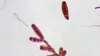 FDA Kukuhkan Kaitan antara Jamur dan Wabah Meningitis