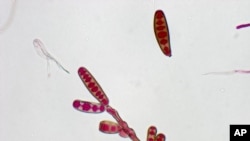 Габата Exserohilum rostratum на која се должат случаите на менингитис во САД. Фотографија на Центрите за контрола и спречување на болестите во Атланта.