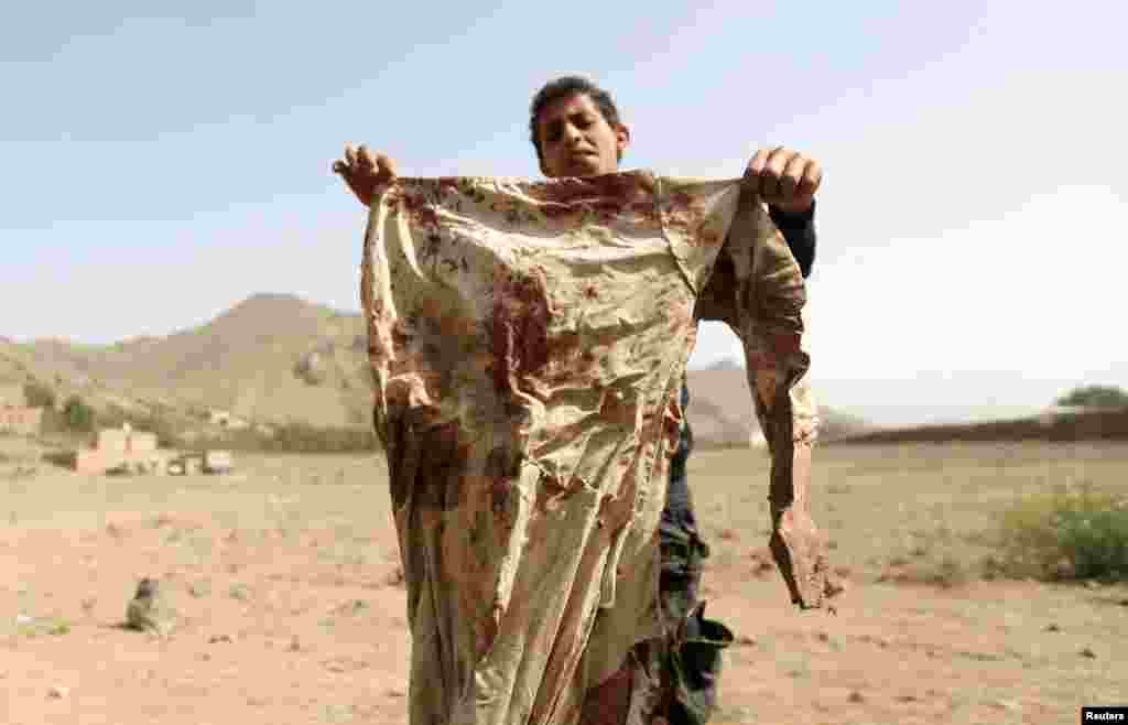 A boy holds a blood-stained garment at the site of an airstrike on a house, in Bait Rejal village, west of Sana&#39;a, April 7, 2015.
