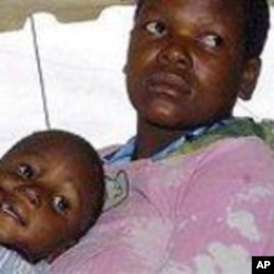 Zimbabwe mother and child with AIDS