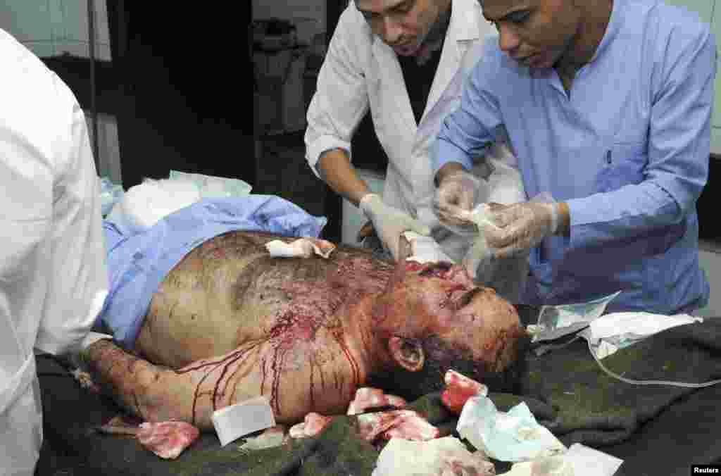 This SANA photo shows medics helping a man who was wounded when bombs exploded in al-Marjeh Square in Damascus, June 11, 2013. 