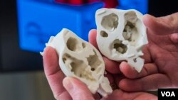 3D-printed model adds new dimension to heart surgery, allowing surgeons to see defects that might not be readily apparent in digital images. (James Carlson, Saint Francis Medical Center)