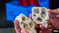 3D-printed model adds new dimension to heart surgery, allowing surgeons to see defects that might not be readily apparent in digital images. (James Carlson, Saint Francis Medical Center)