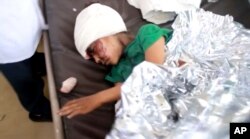 This image made from video taken on Aug. 9, 2018, shows a child injured in an airstrike resting at a hospital in Saada, Yemen.