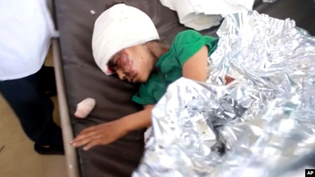 一名在空袭中受伤的也门儿童在萨那医院里被救治。（2018年8月9日）
