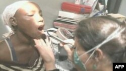 Novi test za tuberkolozu mogao bi da spase milione života