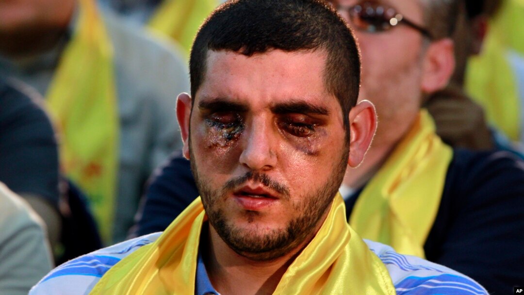 A Hezbollah fighter who was wounded in Qusair, Syria, listens to a speech by Hezbollah leader Sheik Hassan Nasrallah, not shown, during a rally in the southern suburb of Beirut, Lebanon, Friday, June 14, 2013.