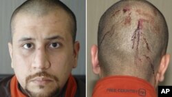 Fotos de George Zimmerman, el vigilante que disparó a Trayvon Martin, que muestran sus heridas en la cabeza, como parte de las más de 200 páginas divulgados el jueves.