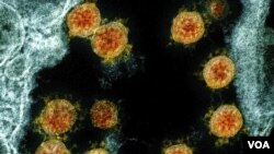 ARCHIVO - imagen de microscopio electrónico proporcionadas por el Instituto Nacional de Alergias y Enfermedades Infecciosas de EEUU en Fort Detrick, Maryland, en 2020, muestra partículas del coronavirus SARS-CoV-2 aisladas de un paciente. 