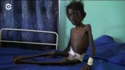 Йемен на грани голода