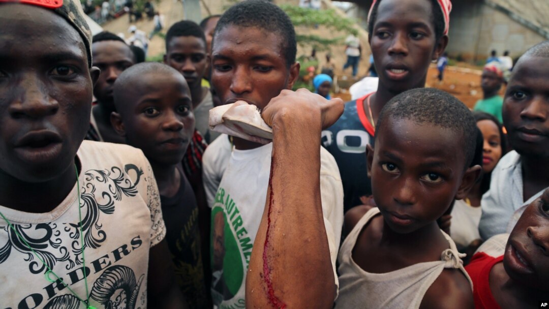 A man shows on his arm where he was injured at a rally in support of UFDG presidential candidate Cellou Dalein Diallo in Conakry, Guinea, Oct. 8, 2015.
