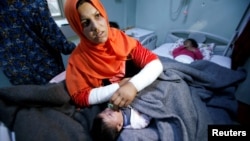 A mother reacts as her daughter Ranmea is treated for possible exposure to chemical weapons agents in a hospital west of Erbil in Mosul, Iraq, March 4, 2017.