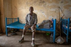 Guesh Tesla, 54-year-old carpenter and Tigrayan survivor from Rawyan, Ethiopia, shows wounds from sticks on his legs, at the Hamdeyat Transition Center near the Sudan-Ethiopia border, eastern Sudan, Dec. 15, 2020.