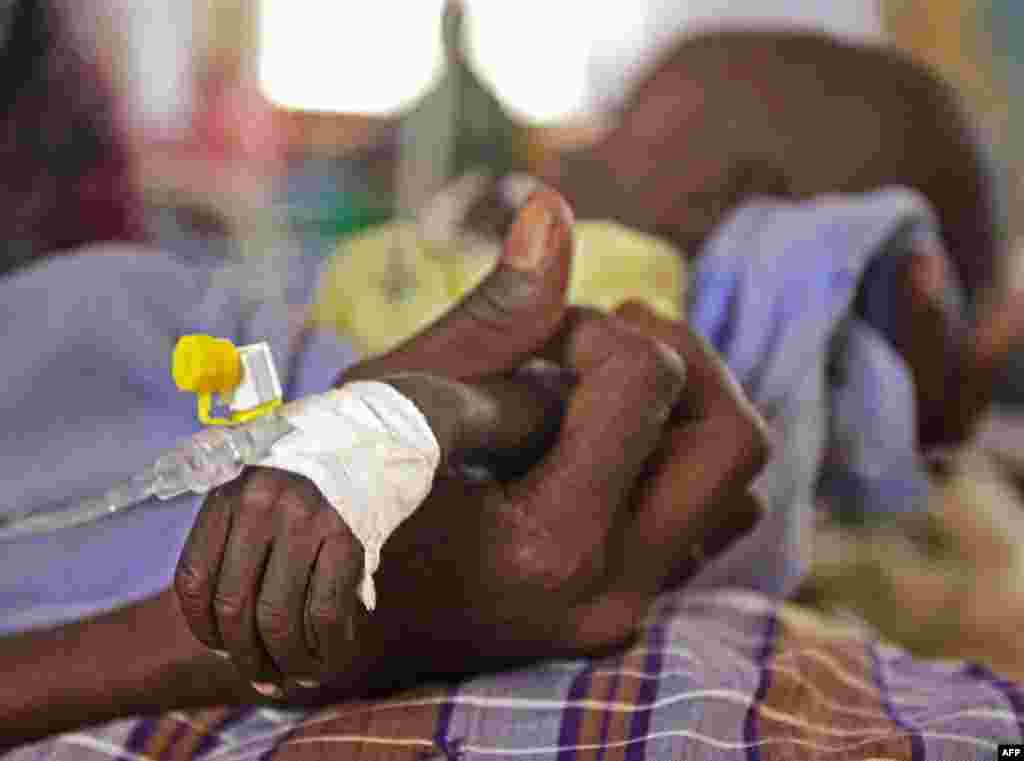 The arm of Minhaj Gedi Farah, a seven-month-old child, is held by his mother in a field hospital of the International Rescue Committee in Dadaab, Kenya, July 26, 2011. (AP)