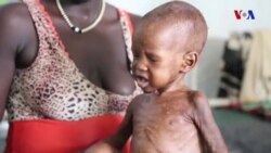 Afrika ölkələrində açlıq
